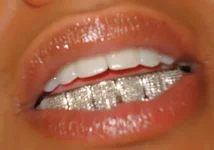 1000020730.webp