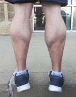 2018-09-Calves.webp