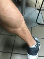 2018-10-02-Post-Spin-Calves.webp